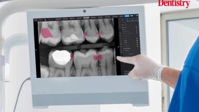 Artificial intelligence is not replacing dentists – it is here to help