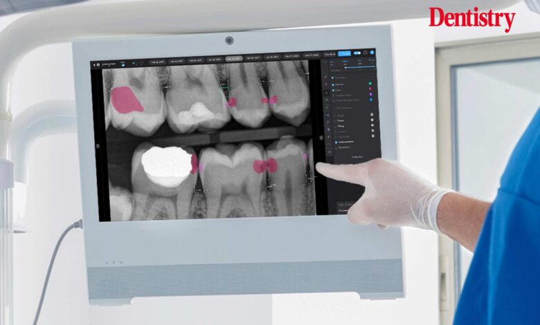 Artificial intelligence is not replacing dentists – it is here to help Artificial intelligence is not replacing dentists – it is here to help