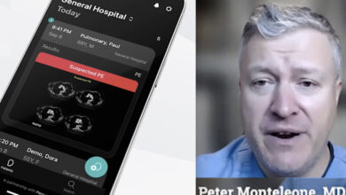 AI critical care software revolutionizes emergency response