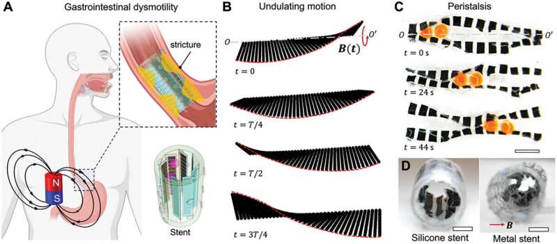 Robotic device restores wavelike muscular function involved in processes like digestion